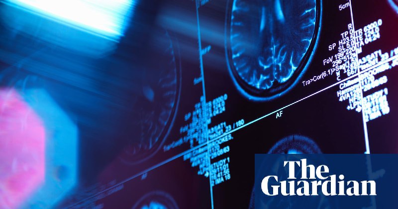 Brain has five ‘eras’, scientists say – with adult mode not starting until early 30s